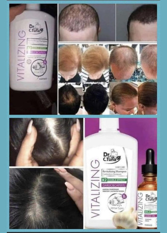 Набор против выпадения и укрепления волос (шампунь, маска, концентрат) Vitalizing Dr. C.Tuna Farmasi (330805516)