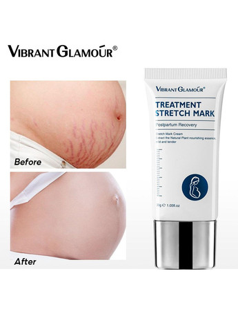 Vibrant Glamour Крем від розтяжок 30г (895) — Крем, Китай (351378884)