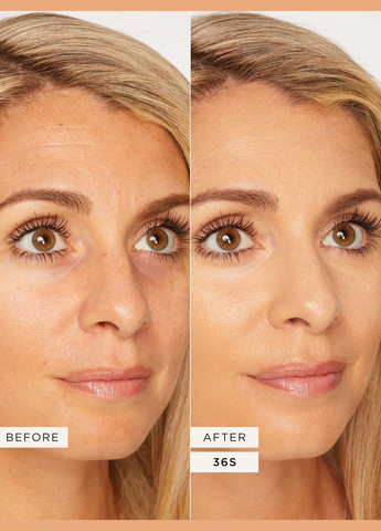 Консилер для губ та обличчя Shape Tape Radiant Concealer відтінок 36S (10 мл) Tarte (331146051)