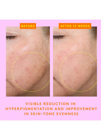 Сироватка для обличчя з вітаміном С C-Firma Fresh Day Serum 4.5+4 ml Drunk Elephant (368718190)