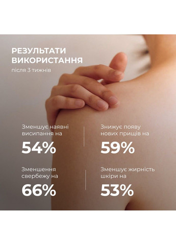 Очищающий гель для тела с салициловой кислотой Anti-Acne Salicylic Body Wash 200 мл Hillary (333828457)