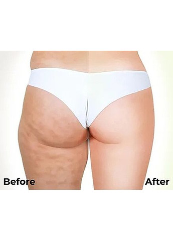 Антицелюлітні обгортання з охолоджувальним ефектом Anti-cellulite Bandage Cooling Effect 110g (1066907-31017939) Hillary (368630795)