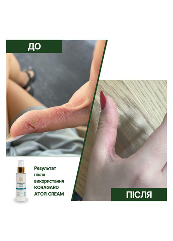 Cила 6 ензимів пілінг-маска 6 enzymes power peel-mask, 50 мл MyIDi (373648939)