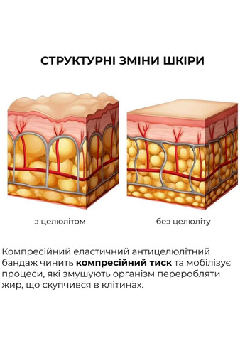 Курс антицеллюлитного ухода в домашних условиях с ниацинамидом Niacinamide Anti-Cellulite Home Care Hillary (332186566)