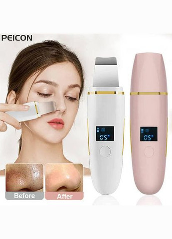 Ультразвуковий скребок для шкіри обличчя, пілінг, видалення чорних цяток, глибоке очищення обличчя, лопатка для пор Anskin (300373380)