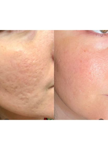 Сыворотка MEDI PEEL Phyto Exosome PDRN Lifting Shot Ampoule Антивозрастная 100 мл (831) Medi-Peel (368831187)