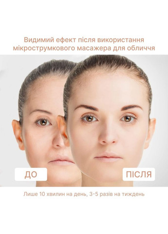 4ems МІКРОСТРУМ ЛІФТИНГ-МАССАЖЕР SKIN LIFTING 6.0 WHITE гарантія 1 рік Medica+ (296785544)