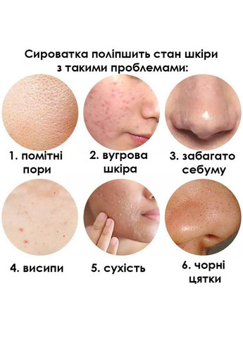 Сыворотка для лица Aloe Essence 30 мл с экстрактом алоэ 2шт Sersanlove (349729623)