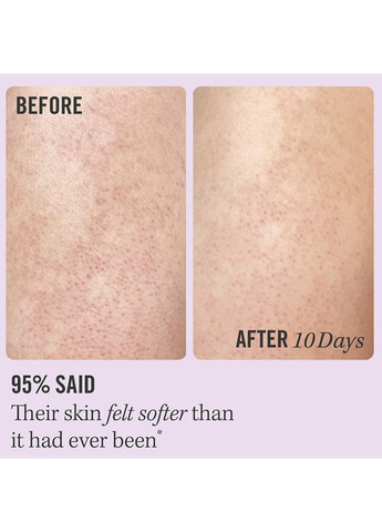 Скраб для тіла KP Bump Eraser Body Scrub with 10% AHA, 56,7 g First Aid Beauty (367832332)