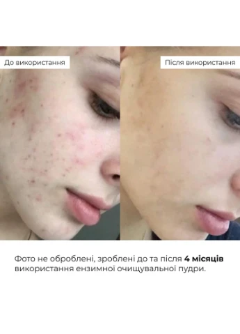 Энзимная очищающая пудра + Тоник для нормальной кожи увлажнение очищение для лица тонизирование. Hillary (387361395)