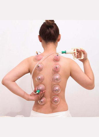 Набір масажних банок 6 штук із вакуумним пістолетом No Brand (370957537)