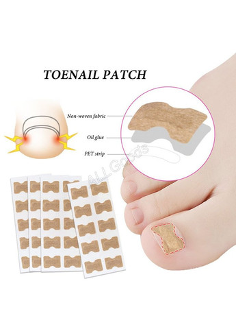 Наклейки від вростання нігтя 10 шт /уп No Brand (304266320)