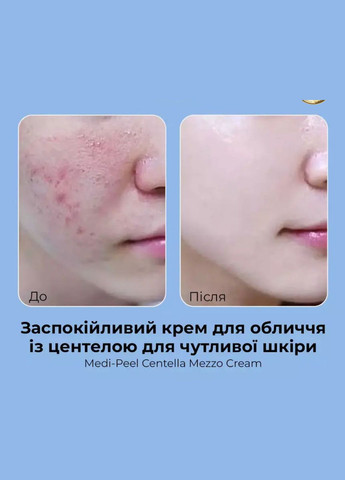 Medi-Peel Лечебный крем MEDI PEEL CENTELLA MEZZO CREAM с экстрактом азиатской центеллы 30 мл (AMA0402) — Крем, Южная Корея (318317622)