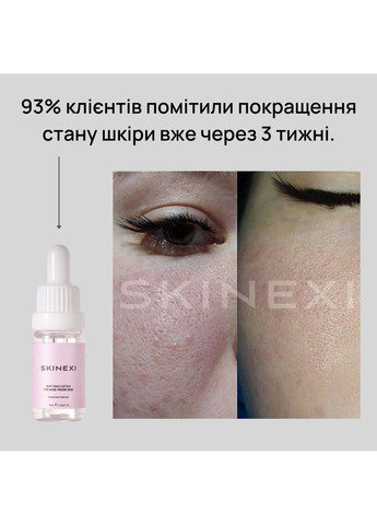Лосьон для проблемной кожи от комедонов и чёрных точек Soft Daily Lotion Skinexi (365284453)