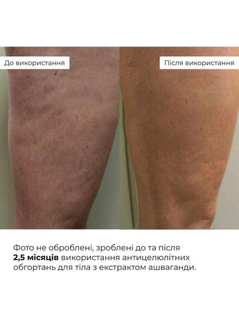 Курс антицелюлітних моделюючих обгортань з екстрактом ашваганди Ashwagandha Hot Slim (6 уп.) Hillary (333828451)