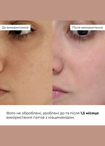 Мультифункціональні та заспокійливі патчі Niacinamide & Centella Hillary (332200489)