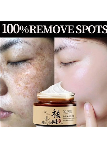 Крем від ластовиння з ретинолом та кислотами Anti-Freckle Whitening для обличчя, 30 г Bioaqua (362588612)