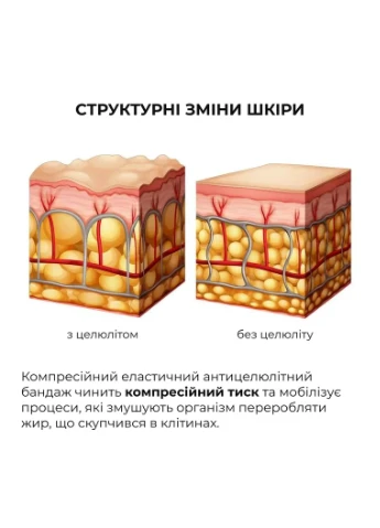 Комплекс розігріваючих антицелюлітних обгортань для тіла Anti-Cellulite Pro (10 уп,) Hillary (387178463)