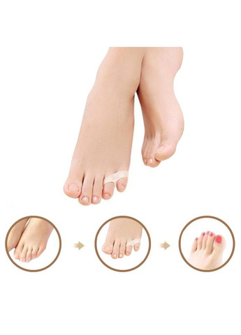 Фиксатор Для Коррекции Мизинца 2шт - Гелевые накладки для коррекции мизинца (500452) Valgus Pro (301872346)