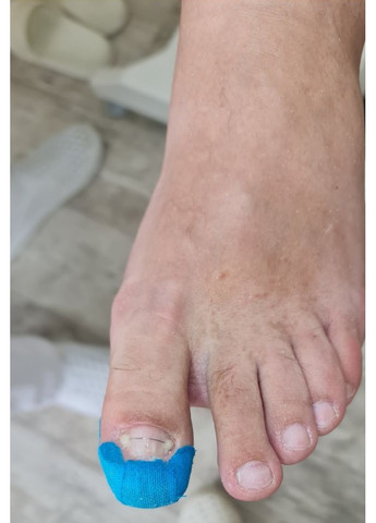 Кинезио тейп 5см*5м ( ) No Brand (369135048)