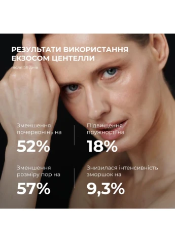 Антигравитационная моделирующая сыворотка с экзомами центеллы для лица и шеи лифтинг сыворотка для молодости кожи. Hillary (387355393)
