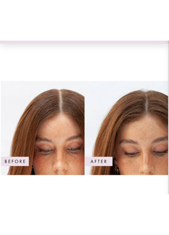 Сухий шампунь Hair Gain Peptide Puff™ Dry Shampoo, 5 g Hair Grant (368504760)