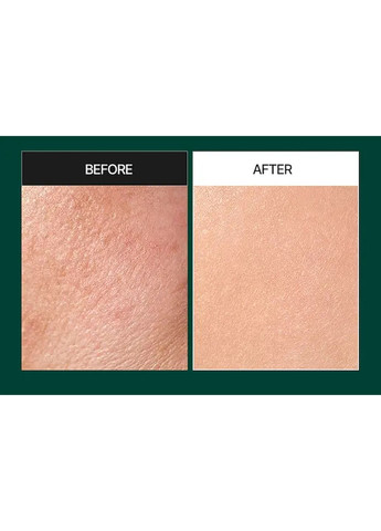 Сироватка-пілінг зі спикулами Phyto Cica-Nol B5 3000 Shot Serum для чутливої та проблемної шкіри обличчя 50 мл Medi Peel (306644181)