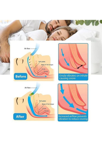 Від хропіння пристрій, зручний затиск на ніс для сну та спокою вночі та вдень, унісекс, 4 штуки набір No Brand (365285204)