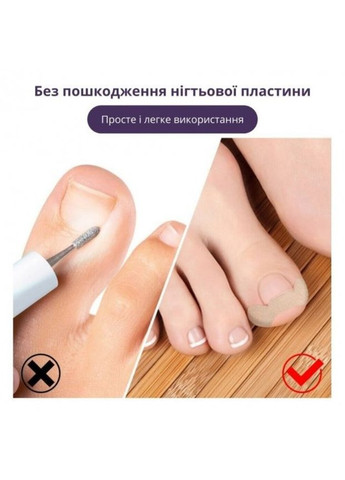 Набор пластырей Elastic Toenail Correction Sticker для врастающих ногтей (50 шт) No Brand (316108951)