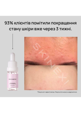Лосьон для проблемной кожи от комедонов и чёрных точек Soft Daily Lotion Skinexi (365284453)