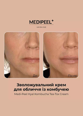 Medi-Peel Ампульный крем для лица с комбучей Hyal Kombucha Tea-Tox Cream, 50 мл — Крем, Южная Корея (303136620)