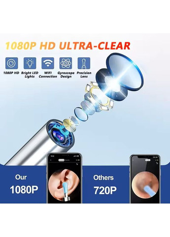 Бездротовий Wi-Fi Отоскоп (ендоскоп) для вух Y39 Black 1080P Full HD з камерою, підсвіткою та набором ложечок China (364233607)