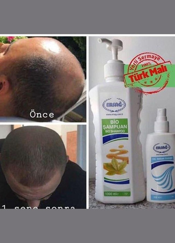 Тоник для ухода за волосами от 200 мл. ERSAG (329436466)