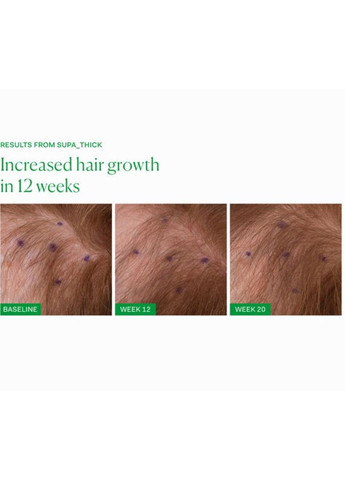 Сироватка для росту волосся The Nue Co Supa Thick, 15 мл The Nue Co. (368722703)