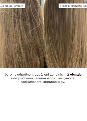 Набор для восстановления волос и кожи головы с салициловой кислотой Salicylic Hair & Scalp Restoration Set Hillary (358525696)