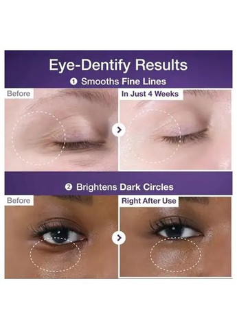 Лифтинг крем для кожи вокруг глаз с пептидами No.9 NAD Retinol Volumetox Eye Cream, 10 мл Numbuzin (370268619)