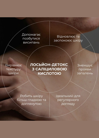 Лосьон-детокс для проблемной кожи с салициловой кислотой Anti-Acne Salicylic Body Lotion, 150 мл Hillary (331914654)