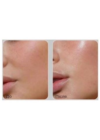Лифтинг-эссенция для лица с пептидами Peptide 9 Volume Lifting All-In-One Essence PRO, 100 мл Medi-Peel (332052421)