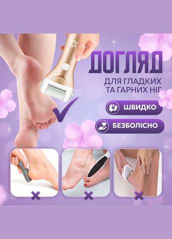 Комплект змінних насадок для роликової пемзи, 3 шт (ZCA-3) No Brand (347590321)