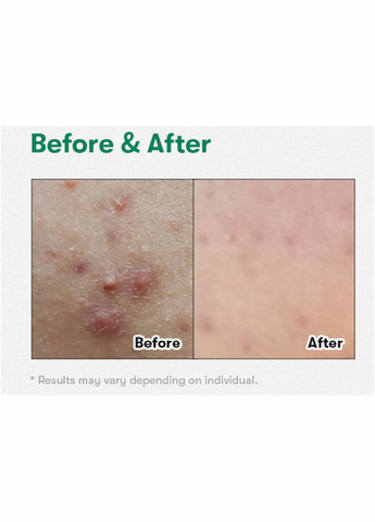 Мікроголковий бустер 100 RETI-A REEDLE SHOT з ретиналем для покращення текстури шкіри (стік), 2 мл VT Cosmetics (314803841)