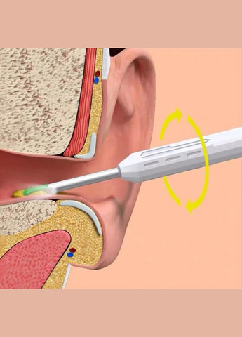 Очиститель ушей с камерой NATFIRE NE17 прибор для удаления ушной серы с отоскопом (2104618531) No Brand (336213344)