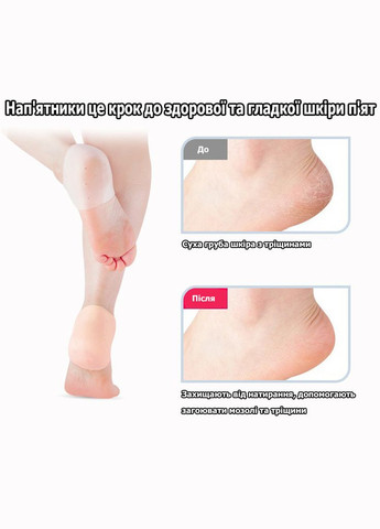 Силіконові підп'ятники від мозолів та тріщин для покращення стану стопи бежеві No Brand (314872853)