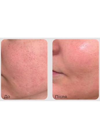 Сыворотка MEDI PEEL Phyto Exosome PDRN Lifting Shot Ampoule Антивозрастная 100 мл (831) Medi-Peel (368831187)