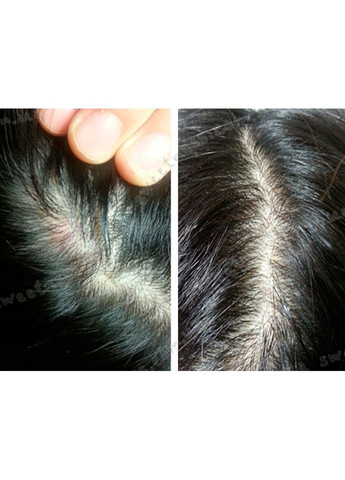 Маска-пілінг для шкіри голови з чайним деревом Lador Tea Tree Scalp Clinic Hair Pack 200 g La'dor (367086332)