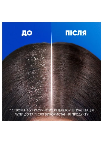 Шампунь против перхоти Основной уход 2-в-1, 250 мл Head & Shoulders (388624747)