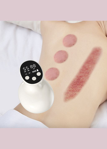 Антицелюлітний вакуумний масажер для тіла ZY-816 No Brand (340274069)