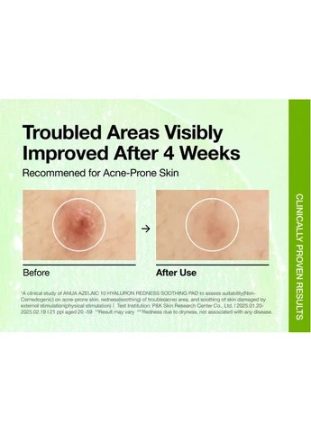 Заспокійливі тонер-педи з азелаїновою кислотою Azelaic 10 Hyaluron Redness Soothing Pad 90 шт Anua (381379433)