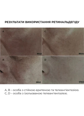 Нічна інтенсивна сироватка з ретиналем Night Intense Retinal Serum, 30 мл Hillary (387359487)
