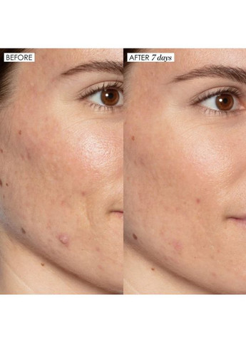 Сироватка Good Genes Lactic Acid Treatment, 5 ml Sunday Riley (368728533)