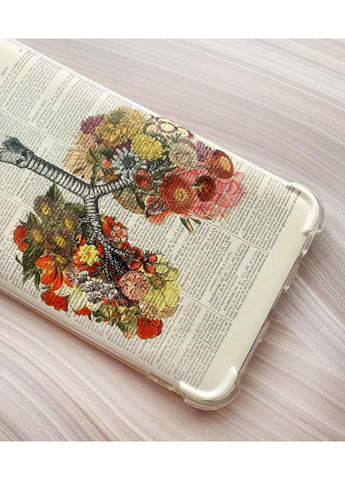 Чохол з потовщеними кутами на Samsung Galaxy A17 5G Легені. Анатомія (принт 299) Creative (356127535)